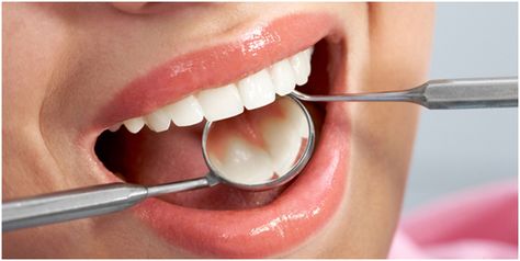 8 Best Home Remedies for Strong Teeth