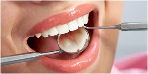 Home remedies for strong teeth